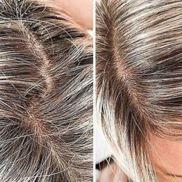 Frank Body Caffeinated Nourishing & Detoxifying Scalp Scrub - Picture 4 of 13